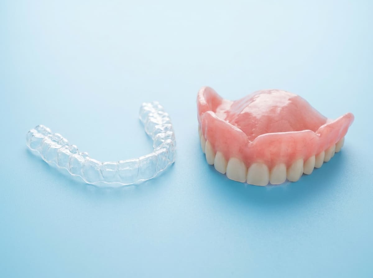 Implant-retained denture with locator attachments.